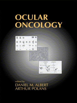 cover image of Ocular Oncology